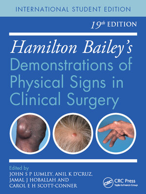 cover image of Hamilton Bailey's Physical Signs